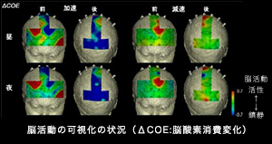 뇌 활동의 시각화 상황 (ΔCOE : 뇌 산소 소비 변화)